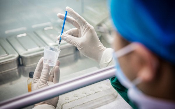 备孕精子不给力 教你提高精子质量